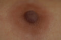 Close up of silicone nipple prosthesis